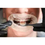 Oral Surgery